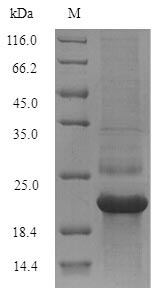 Recombinant Hepatitis C virus genotype 1b Genome polyprotein,partial