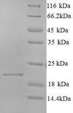 Recombinant Hepatitis C virus genotype 1b Genome polyprotein,partial