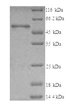 Recombinant Human T-complex protein 1 subunit beta(CCT2)