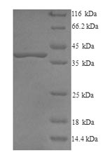 Recombinant Bovine Decorin(DCN)