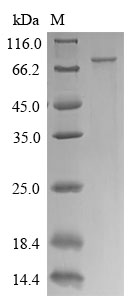 Recombinant Human CTP synthase 1(CTPS1)