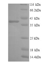 Recombinant Human Interleukin 6 receptor(IL6R),partial