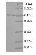 Recombinant Bacillus subtilis 3-oxoacyl-[acyl-carrier-protein] synthase 2(fabF)