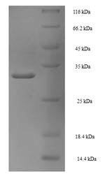 Recombinant Human Proliferating cell nuclear antigen(PCNA)
