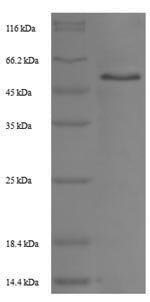 Recombinant Rat Trophoblast glycoprotein(Tpbg)