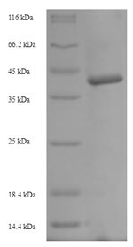 Recombinant Hordeum vulgare Cysteine proteinase EP-B 2(EPB2)
