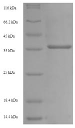 Recombinant Mouse Low affinity immunoglobulin gamma Fc region receptor III(Fcgr3),partial