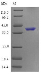 Recombinant Mouse Tumor necrosis factor receptor superfamily member 4(Tnfrsf4),partial