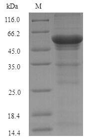 Recombinant Sorangium cellulosum Mannonate dehydratase(uxuA)