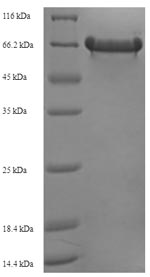 Recombinant Escherichia coli O127:H6 Trigger factor(tig)