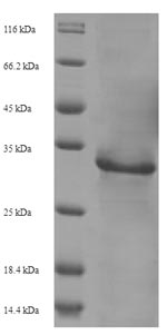 Recombinant Human immunodeficiency virus type 2 subtype A Protein Vpx(vpx)