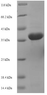 Recombinant Actinoplanes utahensis Aculeacin-A acylase(aac) ,partial