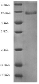 Recombinant Gardnerella vaginalis 5-1 Modification methylase AccI(GV51_0914)