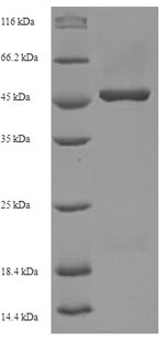 Recombinant Human Oligodendrocyte transcription factor 2(OLIG2)