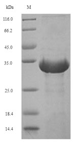 Recombinant Euroglyphus maynei Mite group 2 allergen Eur m 2(EURM2)