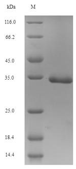 Recombinant Human Small proline-rich protein 3(SPRR3)