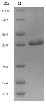Recombinant Human xcitatory amino acid transporter 3(SLC1A1),partial