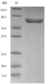 Recombinant Human Procollagen C-endopeptidase enhancer 2(PCOLCE2)