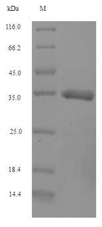 Recombinant Bovine Interferon alpha-G(IFNAG)