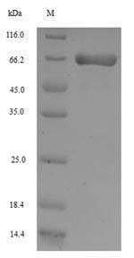 Recombinant Rat Aminopeptidase N(Anpep),partial