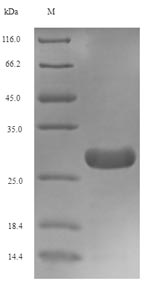Recombinant Xenopus laevis Transforming growth factor beta-1(tgfb1)