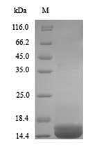 Recombinant Human Apolipoprotein B-100(APOB),partial