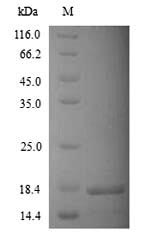 Recombinant Human Potassium channel subfamily K member 2(KCNK2),partial