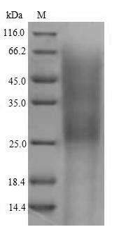 Recombinant Mouse Complement receptor type 2(Cr2),partial