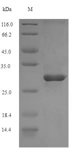 Recombinant Mouse Complement receptor type 2(Cr2),partial
