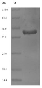 Recombinant Human Vesicle-associated membrane protein 2(VAMP2)