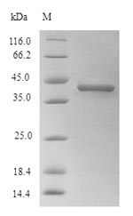 Recombinant Zaire ebolavirus Pre-small/secreted glycoprotein(GP)