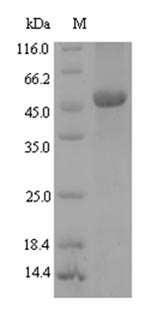 Recombinant Xanthomonas campestris pv. campestris NAD-dependent deacetylase(cobB)
