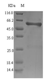 Recombinant Salmonella typhi Outer membrane protein S1(ompS1)
