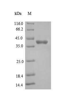 Recombinant Mouse Tyrosine-protein kinase JAK1(Jak1),partial