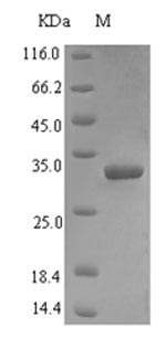 Recombinant Human Vacuolar protein sorting-associated protein 13A(VPS13A),partial