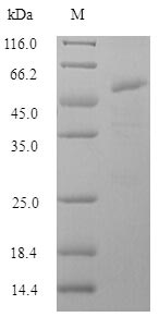 Recombinant Influenza A virus Hemagglutinin(HA) ,partial