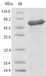 Recombinant Bacillus sp. Unsaturated glucuronyl hydrolase(ugl)