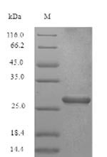 Recombinant Chicken anemia virus Apoptin(VP3)
