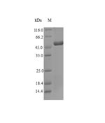 Recombinant Dermatophagoides farinae Tropomyosin
