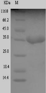 Recombinant Escherichia coli Translocated intimin receptor Tir(tir),partial