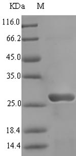 Recombinant Pyrococcus furiosus DNA/RNA-binding protein Alba(albA)