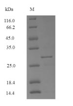 Recombinant Mercurialis annua Profilin