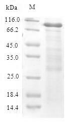 Recombinant Mouse Cystathionine beta-synthase(Cbs)