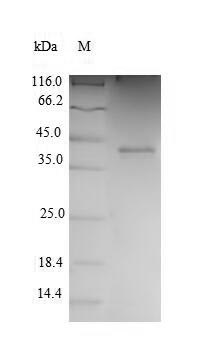 Recombinant Human Cyclin-dependent kinase 2(CDK2)
