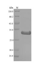Recombinant Cynodon dactylon Profilin(PRO1)