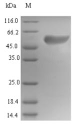 Recombinant Human Islet cell autoantigen 1(ICA1)