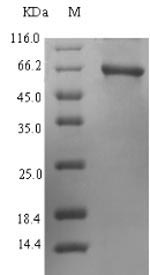 Recombinant Human Protoporphyrinogen oxidase(PPOX)