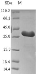 Recombinant Mouse Thyroid hormone-inducible hepatic protein(Thrsp)