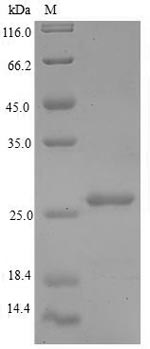 Recombinant Human 60S acidic ribosomal protein P1(RPLP1)