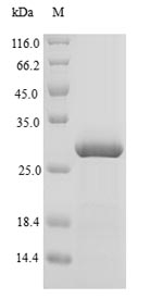 Recombinant Bovine Agouti-signaling protein(ASIP)